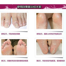 baby exfoliating foot mask peeling renewal remove dead skin cuticles feet care TIML66
