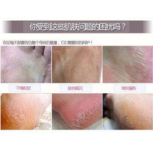 baby exfoliating foot mask peeling renewal remove dead skin cuticles feet care TIML66
