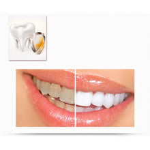 2ml Transparent White Teeth High Strength Whitening Gel Pen Whitener Tooth Pen Dental Equipment LE2 TIML66
