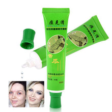 30g Acne Cream Blain Products Desalt Blain To Imprint Face Cream Face Treatment TIML66