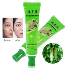 30g Acne Cream Blain Products Desalt Blain To Imprint Face Cream Face Treatment TIML66