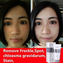 fade dark spots face mask whitening and spot removal products moisturizing exfoliator anti wrinkle skin care masks 40g TIML66