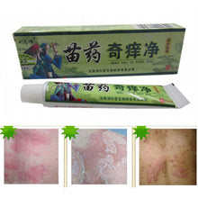 Net Herbal Itch Cream Fungal Infections Foot And Ringworm Balanitis Hemorrhoids Anti-itch Body Creams TIML66