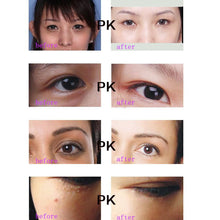 30g Anti-Dark Circle Wrinkle Anti Puffiness Wrinkles Gold Snail Repair Eye Cream TIML66