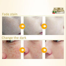 Face Skin Whitening Remove Freckle Speckle Peel Dark Spot Wrinkles Cream TIML66