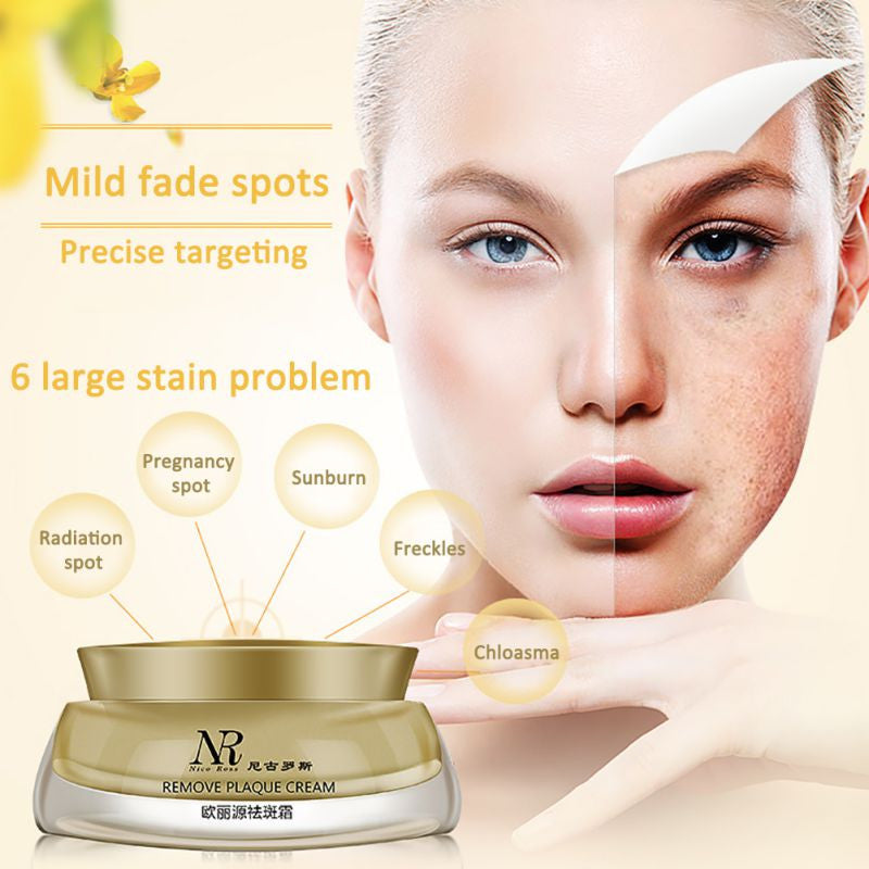 Face Skin Whitening Remove Freckle Speckle Peel Dark Spot Wrinkles Cream TIML66
