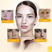 Face Skin Whitening Remove Freckle Speckle Peel Dark Spot Wrinkles Cream TIML66