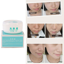 powerful whitening freckle cream remove melasma acne spots pigment melanin face care cream TIML66